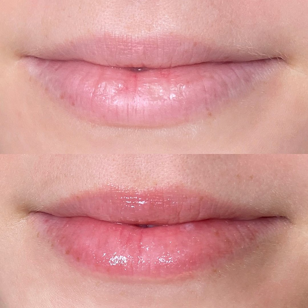 Lip blush before and after