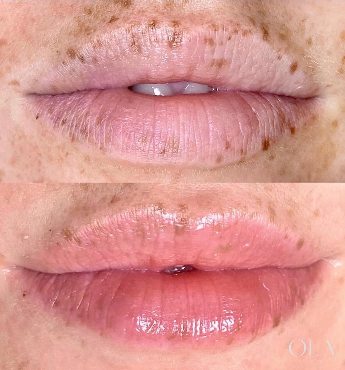 Lip blush before and after